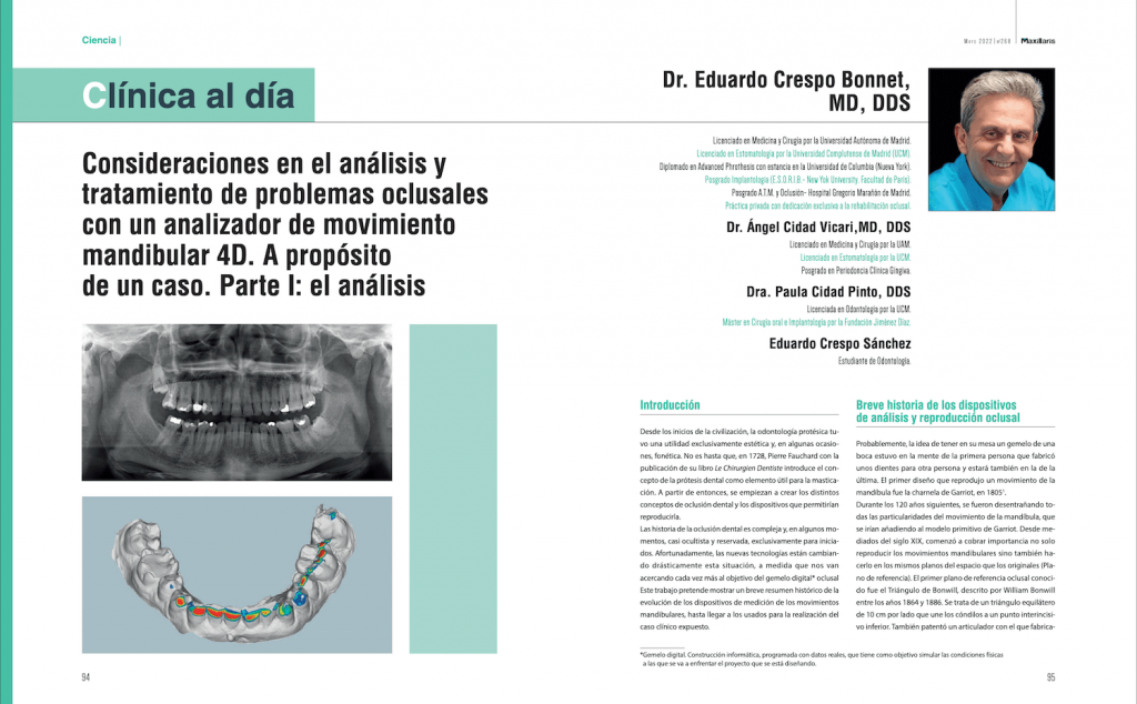 Consideraciones en el análisis y tratamiento de problemas oclusales con un analizador de movimiento mandibular 4D. A propósito de un caso
